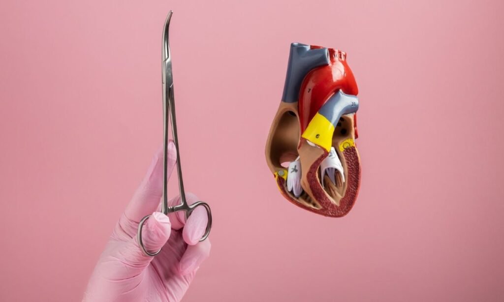 Transcatheter Mitral Valve Replacement