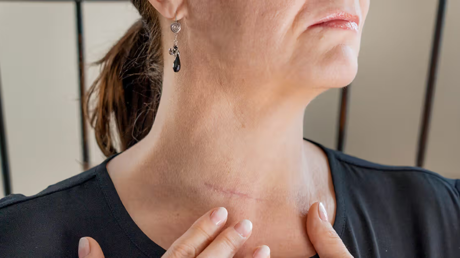 Rare Thyroid Cancer Surgery Gives Young Woman Second Chance at Life Without Losing Voice