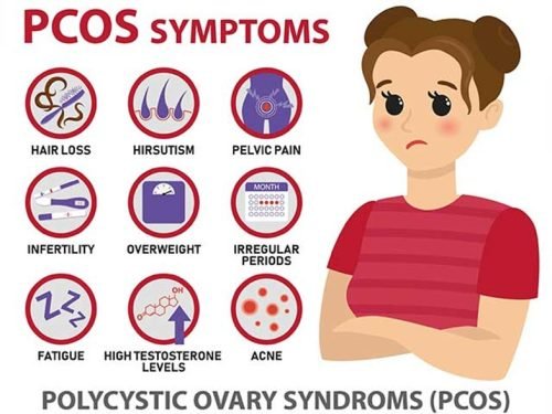 Common Symptoms of PCOD